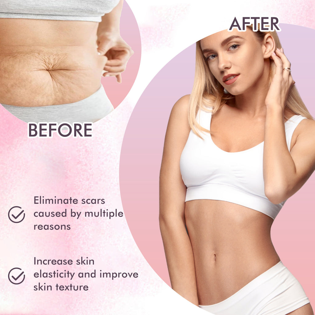 $19.57 - Body Treatment Oil, reduces scars and pregnancy stretch marks, moisturizes and repairs delicate and smooth body skin