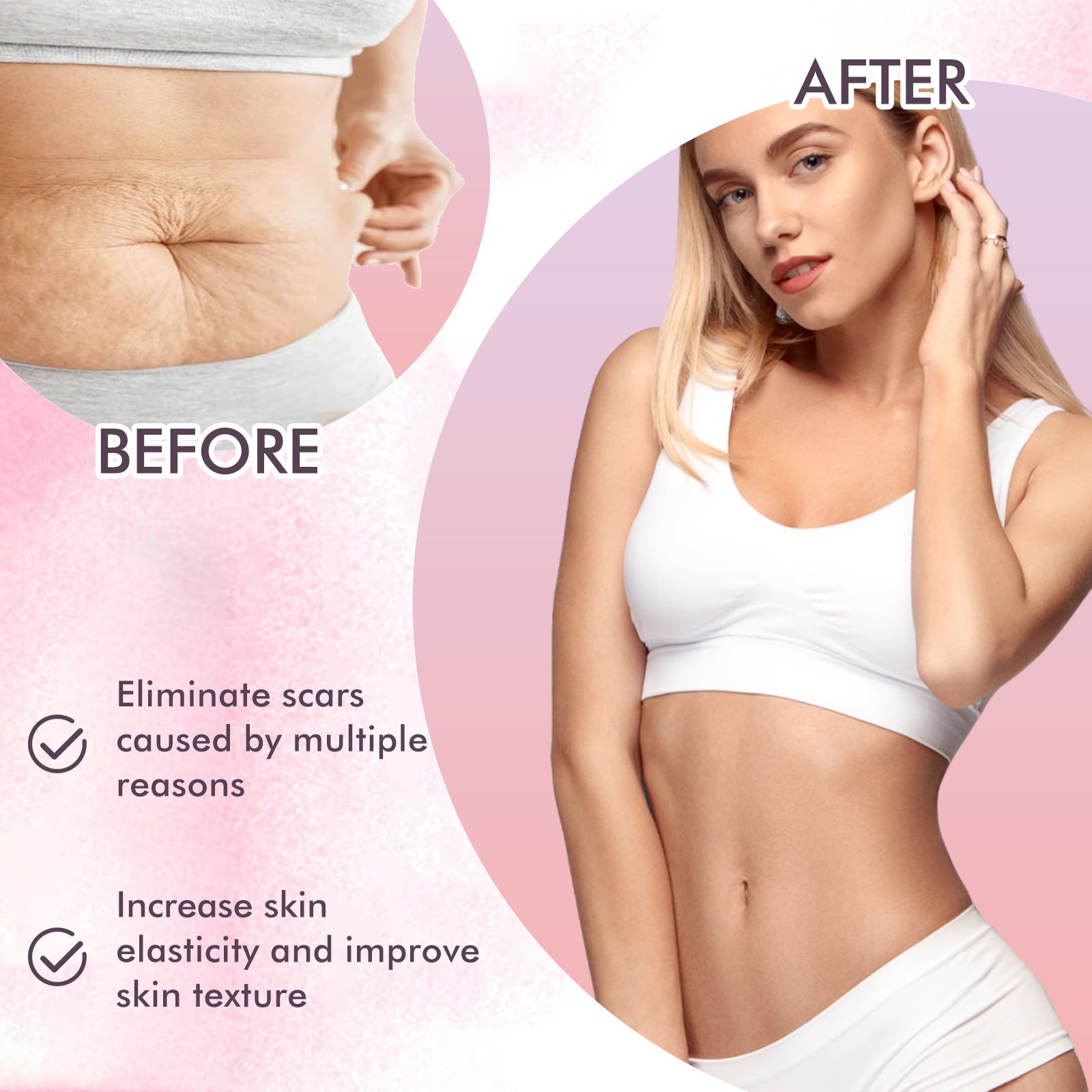 $19.57 - Body Treatment Oil, reduces scars and pregnancy stretch marks, moisturizes and repairs delicate and smooth body skin
