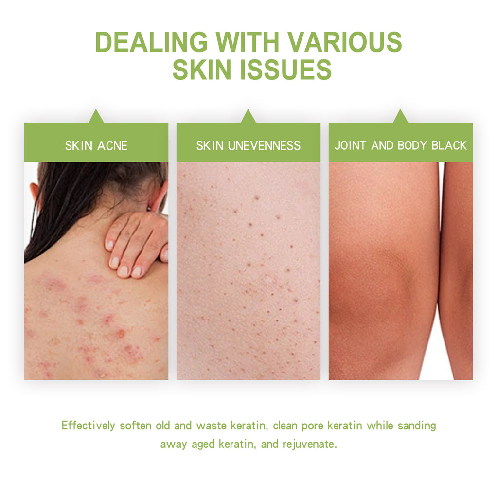 $24.57 - OCEAURA Avocado Exfoliating Body Scrub, for clear skin, removes dead cells and leaves skin smooth and radiant.