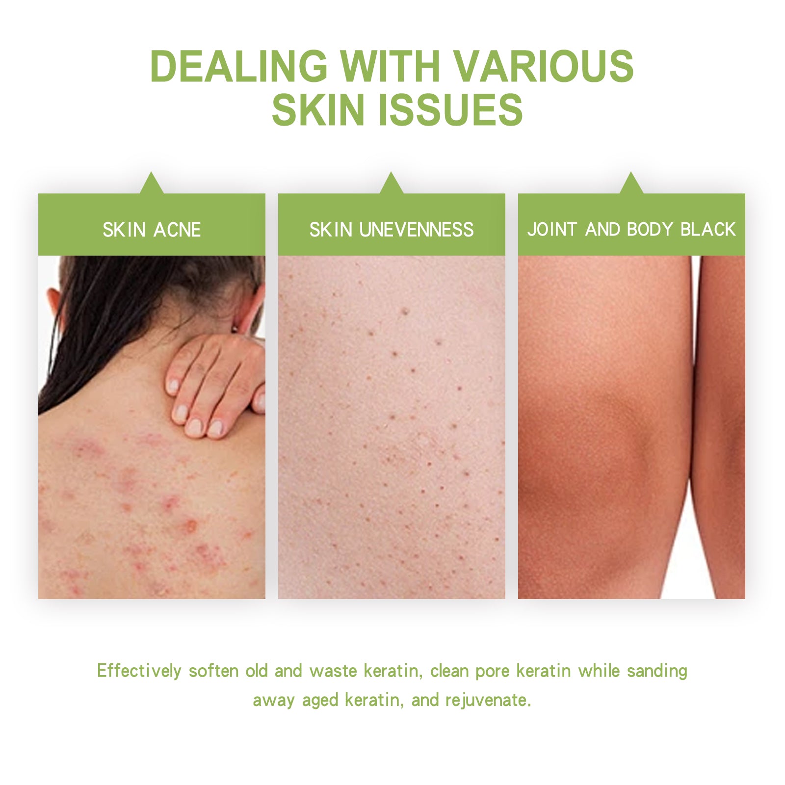 $24.57 - OCEAURA Avocado Exfoliating Body Scrub, for clear skin, removes dead cells and leaves skin smooth and radiant.