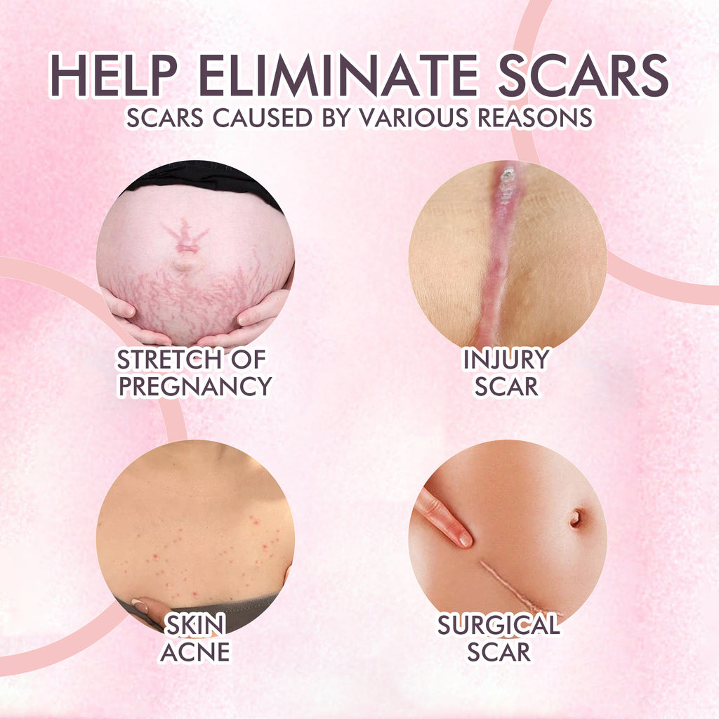 $19.57 - Body Treatment Oil, reduces scars and pregnancy stretch marks, moisturizes and repairs delicate and smooth body skin